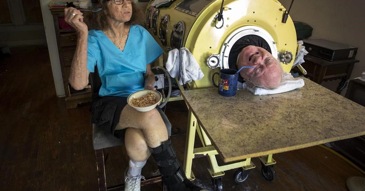 Paul Alexander thrived while using an iron lung for decades after contracting polio as a child [Video]