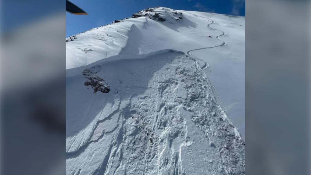 Kananaskis Country avalanche partially buries skier [Video]