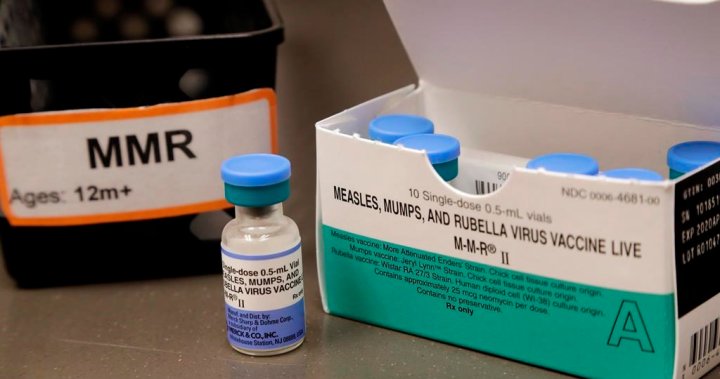 Another case of measles reported in Ontario through travel [Video]