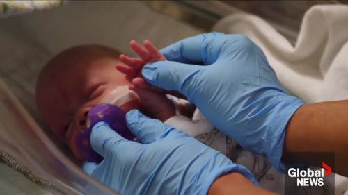 Edmonton doctors warn of NICU crisis that could lead to baby deaths [Video]