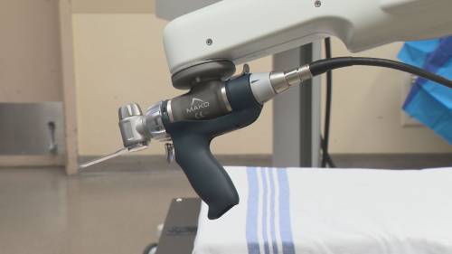 Health Matters: Game-changing robotic surgery technology comes to Burnaby Hospital [Video]