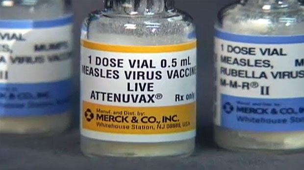 Albertans should check measles vaccine status: expert [Video]