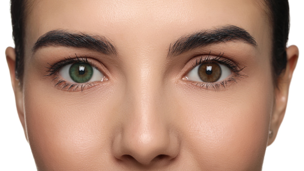 Eye colour change: B.C. optometrist warns against Keratopigmentation [Video]