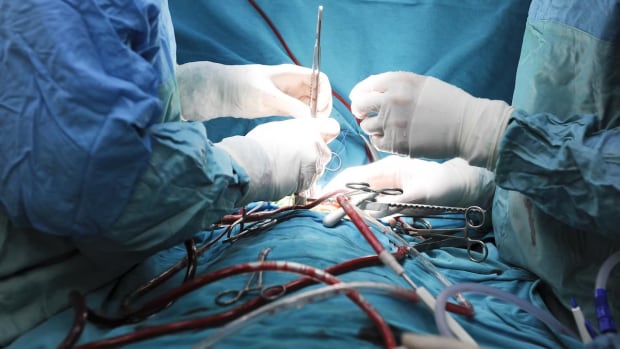 Surgical waits vary a lot between Ontario hospitals: study [Video]