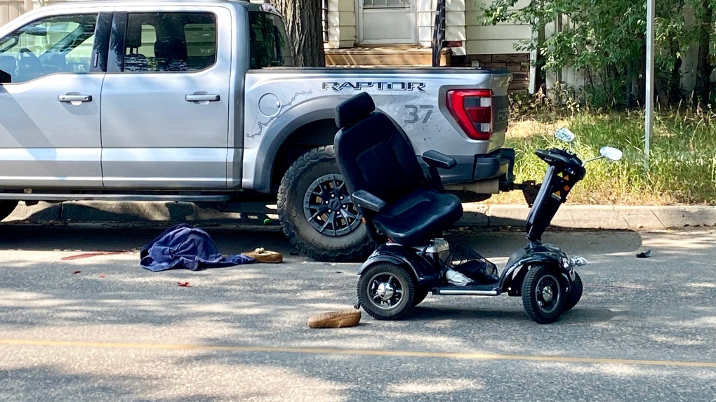 Man seriously injured after collision involving scooter: Regina police [Video]