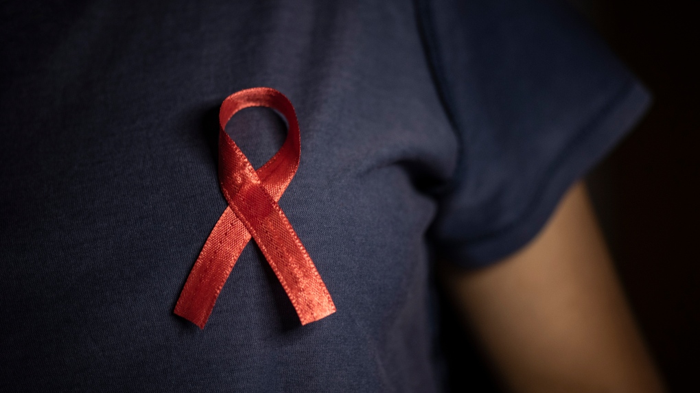 HIV therapy and treatment: New research for Indigenous patients [Video]