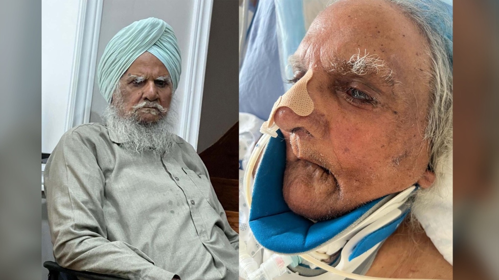 Ontario family speak out against Toronto-area hospital after Sikh man’s beard shaved [Video]