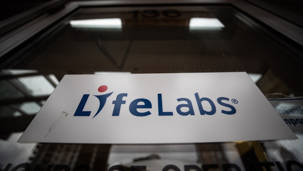 LifeLabs workers in Kitchener prepared to strike if deal isnt reached by Saturday [Video]