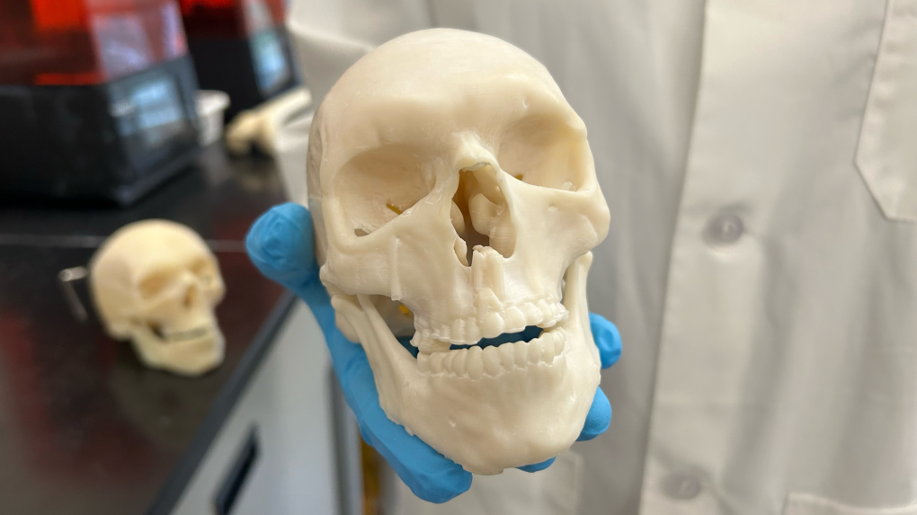 University of Waterloo developing 3D-printed bones to improve outcomes for cancer patients [Video]