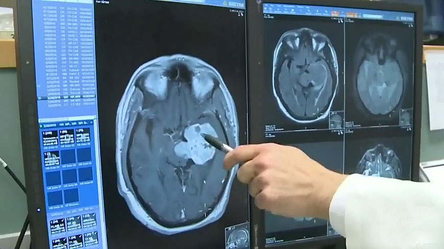 Brain injury association spreads concussion awareness [Video]