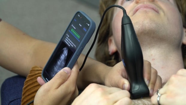 London medical startup attracts international attention with AI ultrasound tech [Video]