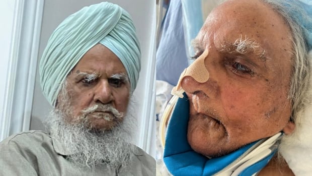 Hospital system apologizes after Brampton Sikh man’s beard shaved [Video]