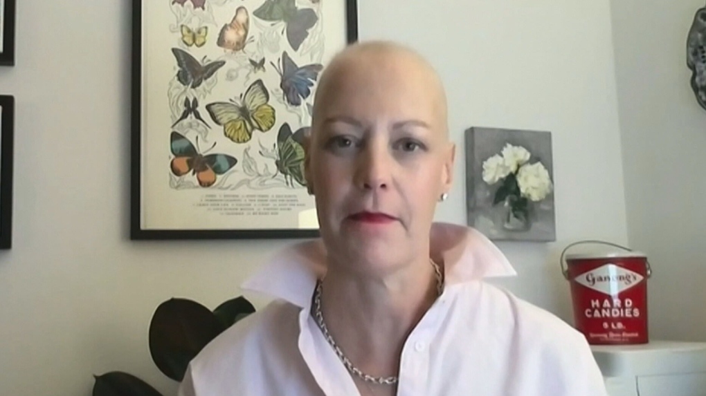 Breast cancer survivor shares journey [Video]