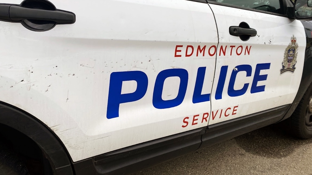 Edmonton cyclist hospitalized after robbery [Video]