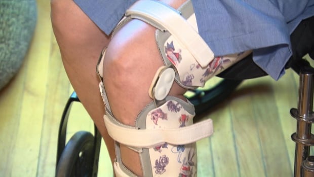 Weeks after P.E.I. regulates podiatry, another health profession calls for similar rules [Video]