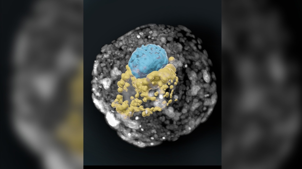 Unlocking the black box of early human development without an egg, sperm, or womb [Video]