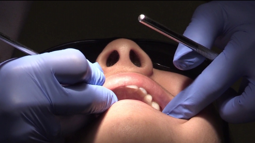 20% of Albertans have persistent oral health problems [Video]