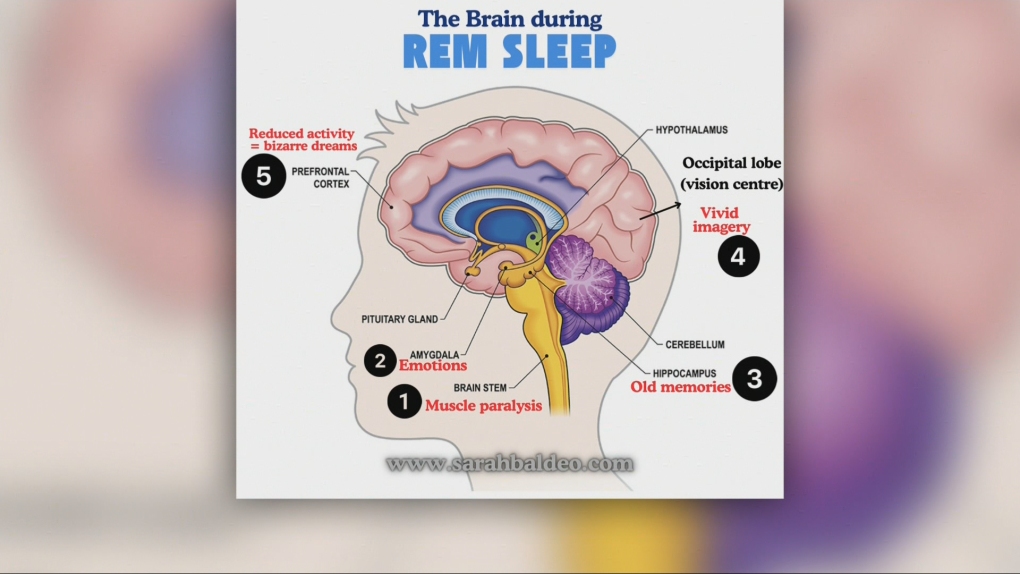 Explaining your brain activity while you’re dreaming [Video]