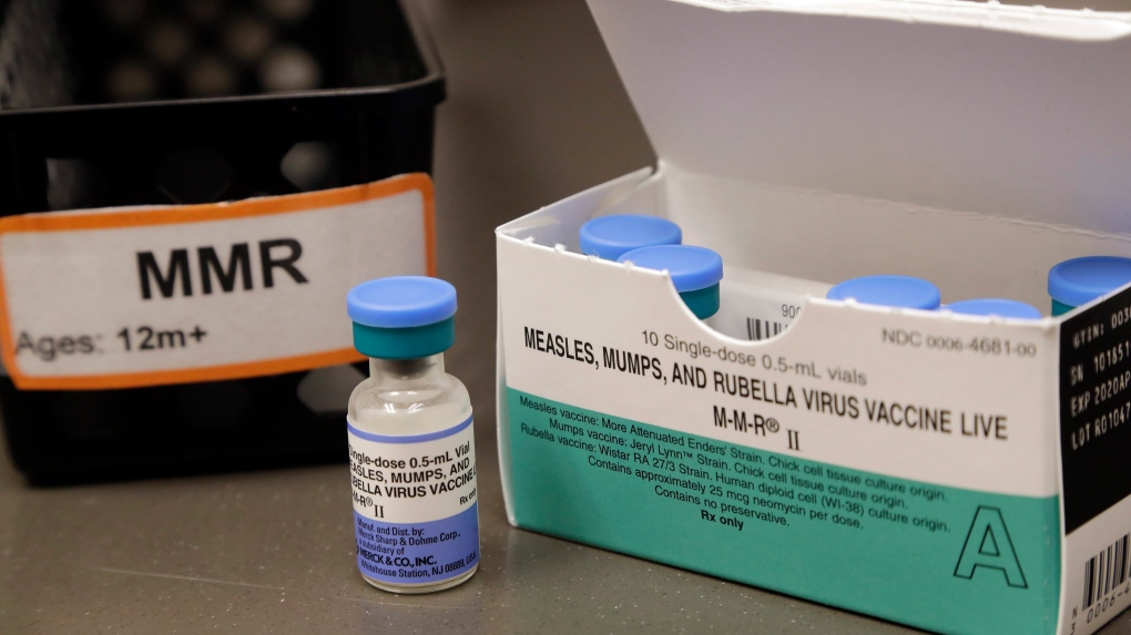 11 new cases of measles confirmed in N.B. [Video]