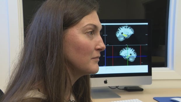 Is bilingualism good for your brain? Montreal researchers are seeing tangible results [Video]