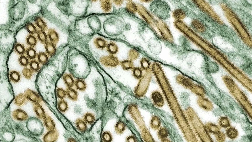 Avian flu: Canada’s first human case confirmed in B.C. [Video]