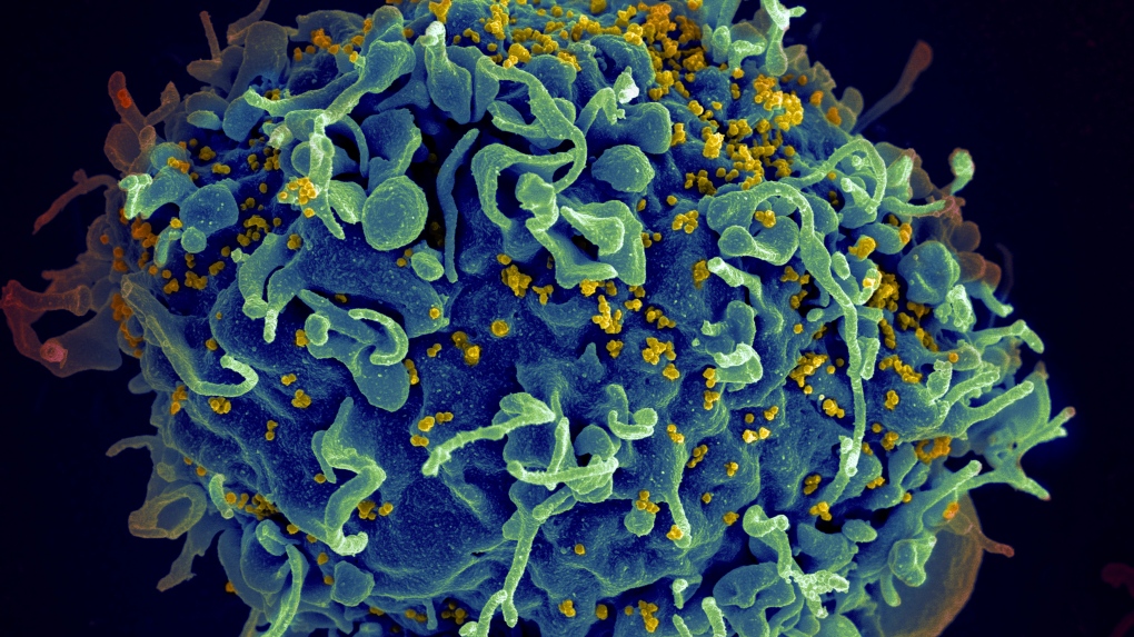 Montreal researchers make breakthrough discovery in fighting HIV [Video]