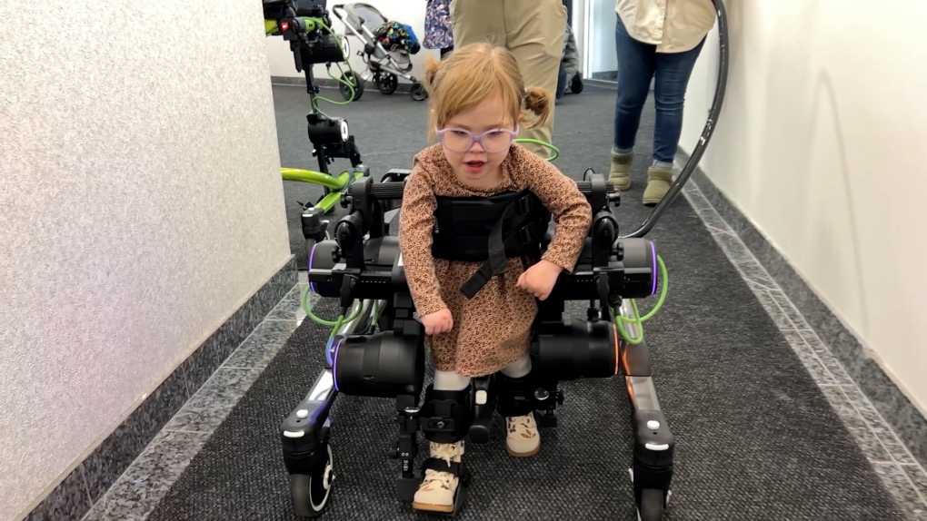 Trexo Robotics technology helps children with disabilities walk for the first time [Video]