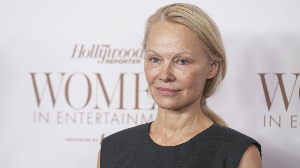 Golden Globe nominations: Pamela Anderson, ‘Dune’ [Video]