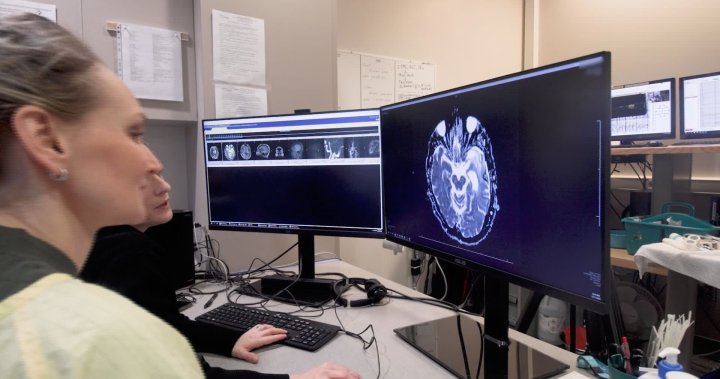 Epilepsy patient becomes nurse at the same B.C. hospital unit that changed her life [Video]