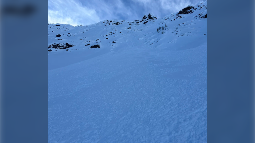 Revelstoke avalanche leaves skier seriously injured [Video]