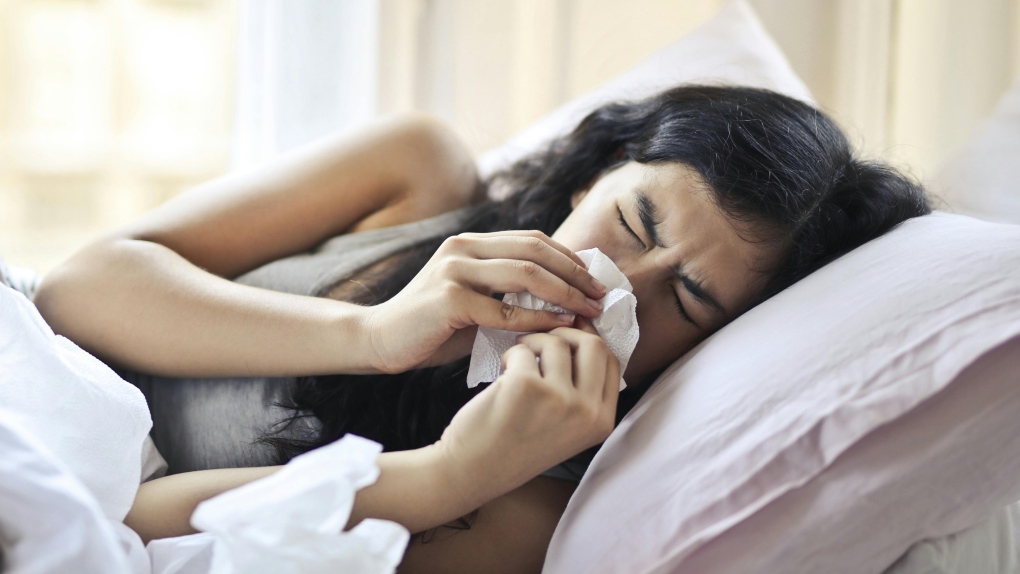 Whooping cough outbreaks in Canada: What health officials say [Video]