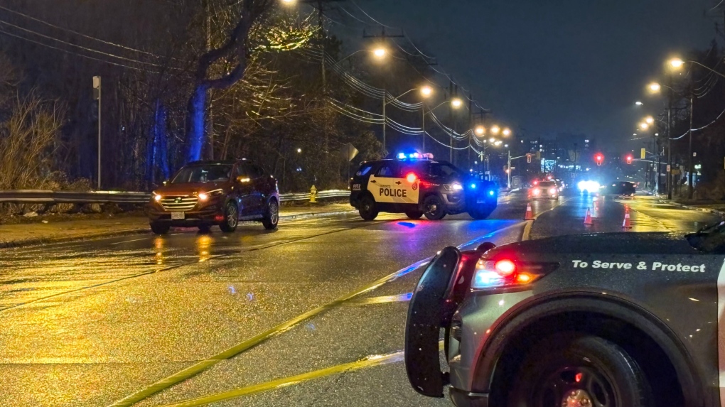 Child struck by vehicle in North York seriously injured: EMS [Video]