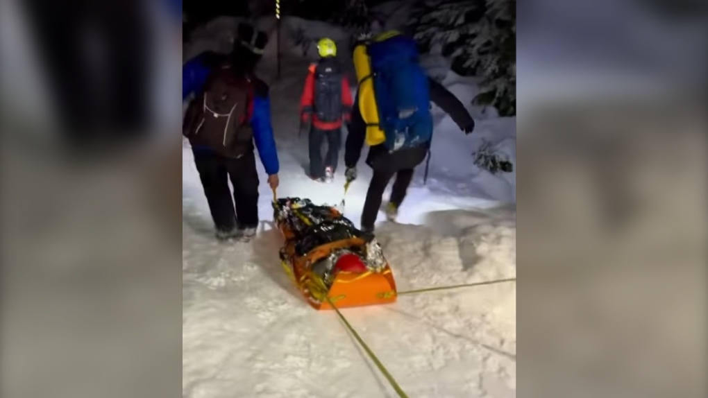 Woman rescued after bum sliding down West Vancouver mountain and fracturing ankle [Video]