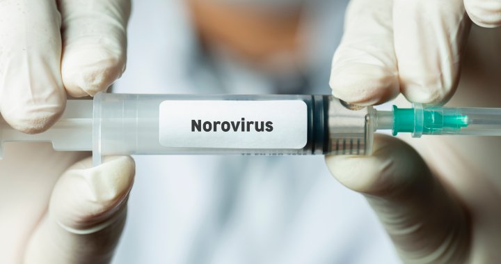 Sick of the stomach bug? Moderna is making a norovirus vaccine - National [Video]