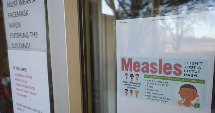 Child who died in Texas measles outbreak was unvaccinated, officials say – National [Video]