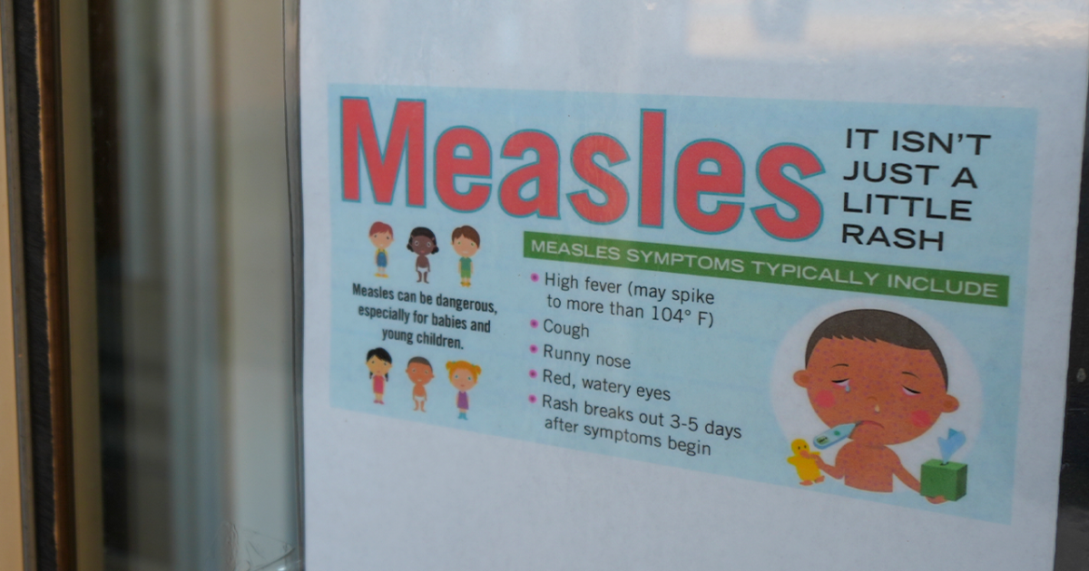 Buffalo health experts weigh in on rise of measles in U.S. [Video]