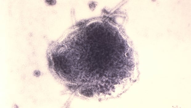 Ottawa has 1st confirmed measles cases since 2019 [Video]