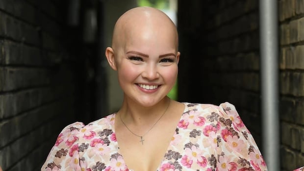 What women need to know about hair loss [Video]