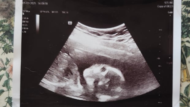 I never imagined my 4th pregnancy would be my first without a family doctor [Video]