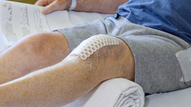 It’s much faster to get hip or knee replacements if there’s a central waitlist: study [Video]