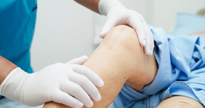 The secret to faster hip and knee surgeries? Fixing referrals, study says – National [Video]