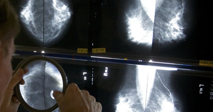 Saskatchewan scientists make breakthrough in breast cancer research [Video]