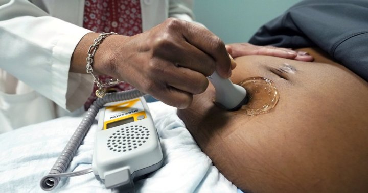 COVID shot is safe during pregnancy, Canadian doctors say after U.S. move – National [Video]