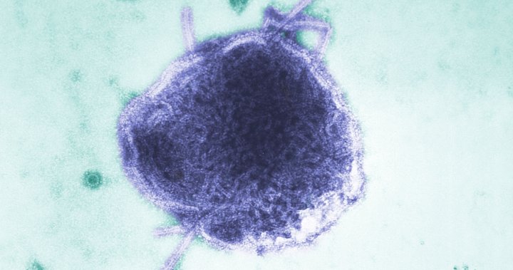 Alberta surpasses 700 confirmed measles cases [Video]