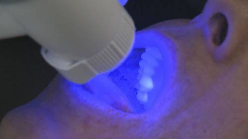 Importance of dental health for seniors [Video]