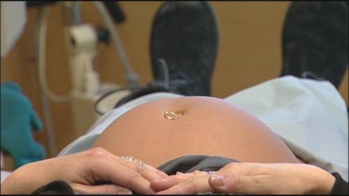Doctors speak about risks of measles vaccine during pregnancy [Video]